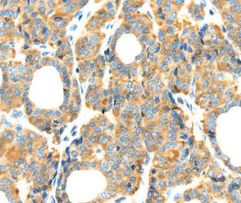 Anti-Human RIPK4 Antibody