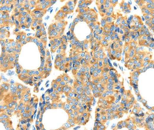 Anti-Human RIPK4 Antibody