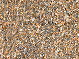 Immunohistochemistry of paraffin-embedded Human tonsil tissue using NLRC4 Polyclonal Antibody at dilution of 1:50(×200)