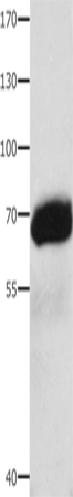Anti-Human AFP Antibody - ABMIUM