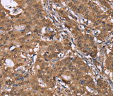 Anti-Human HLTF Antibody - ABMIUM