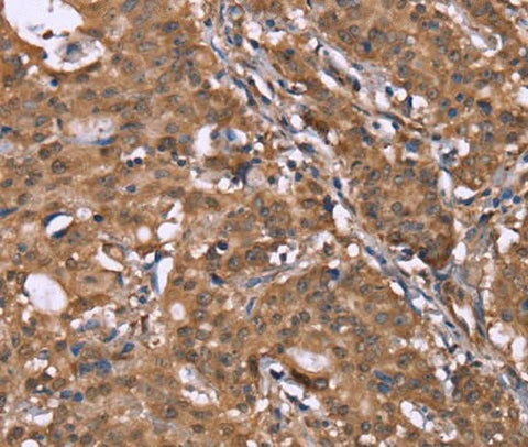 Anti-Human HLTF Antibody - ABMIUM