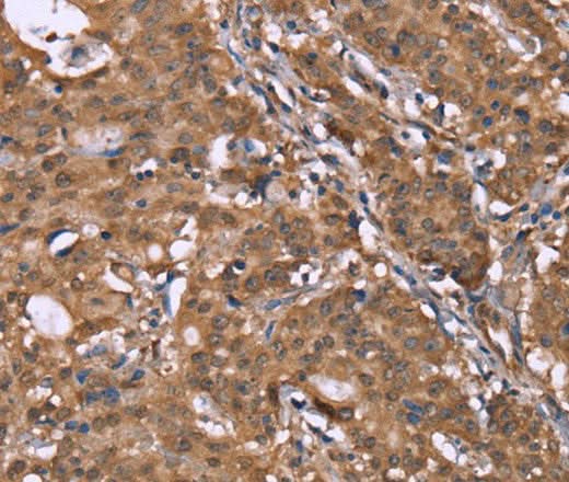 Anti-Human HLTF Antibody - ABMIUM
