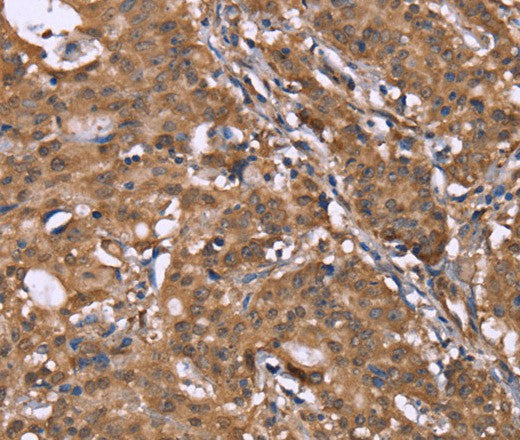 Anti-Human HLTF Antibody - ABMIUM