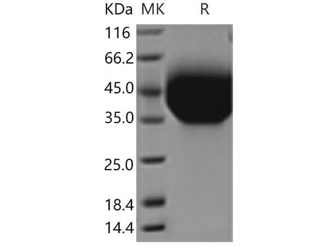 Recombinant Mouse TIM-3/HAVCR2 Protein (aa 1-191, His Tag) - ABMIUM