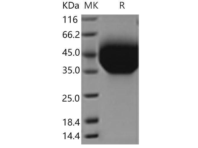 Recombinant Mouse TIM-3/HAVCR2 Protein (aa 1-191, His Tag) - ABMIUM