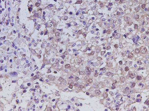 Anti-Human RUNX2 Antibody - ABMIUM