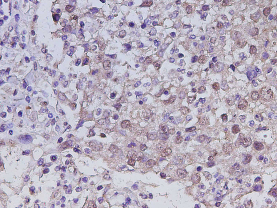 Anti-Human RUNX2 Antibody - ABMIUM