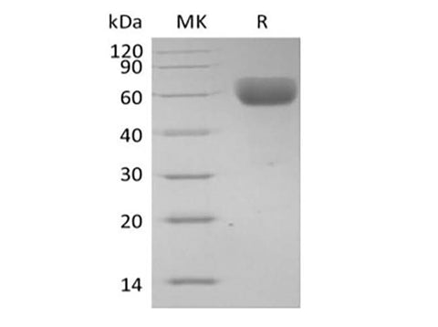 Recombinant Human Basigin/CD147 (C-Fc) - ABMIUM