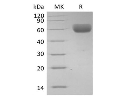 Recombinant Human Basigin/CD147 (C-Fc) - ABMIUM
