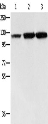 Anti-Human/Mouse/Rat HSPH1 Antibody - ABMIUM