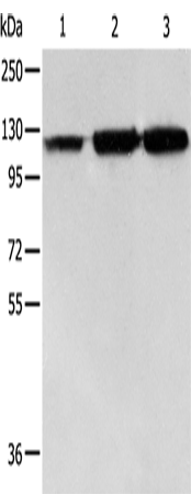 Anti-Human/Mouse/Rat HSPH1 Antibody - ABMIUM