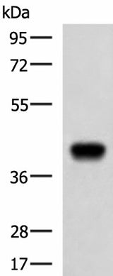 Western blot analysis of Ramos cell lysate using FCRLA Polyclonal Antibody at dilution of 1:750