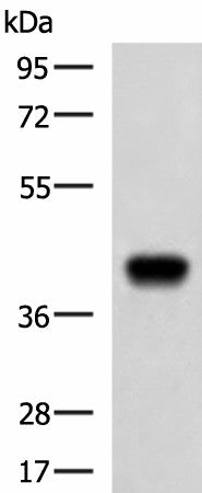 Western blot analysis of Ramos cell lysate using FCRLA Polyclonal Antibody at dilution of 1:750