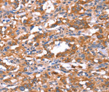 Anti-Human/Mouse FAM13B Antibody - ABMIUM