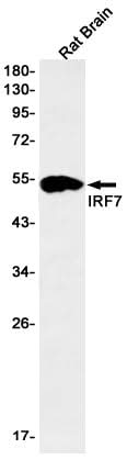 Western blot detection of IRF7 in Rat Brain lysates using IRF7 Rabbit mAb(1:1000 diluted).Predicted band size:54kDa.Observed band size:54kDa.