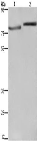 Anti-Human/Mouse/Rat COMP Antibody - ABMIUM
