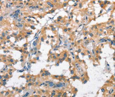 Anti-Human SCARB1 Antibody