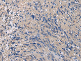 Anti-Human/Mouse/Rat CHST3 Antibody - ABMIUM