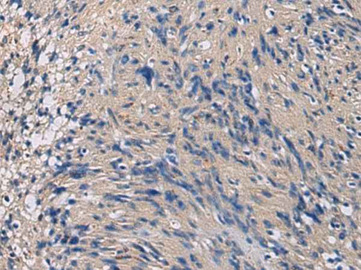Anti-Human/Mouse/Rat CHST3 Antibody