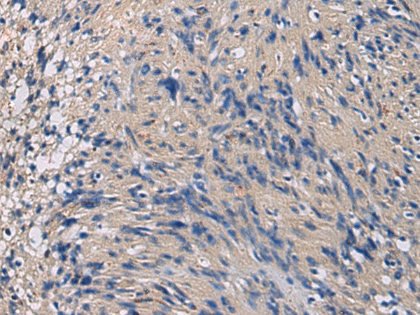 Anti-Human/Mouse/Rat CHST3 Antibody - ABMIUM