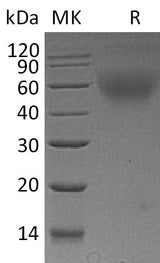 Recombinant Mouse CD30/TNFRSF8 Protein (His Tag) - ABMIUM