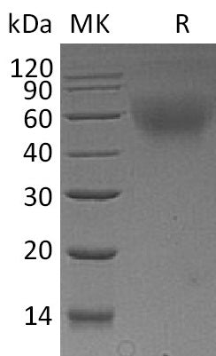Recombinant Mouse CD30/TNFRSF8 Protein (His Tag) - ABMIUM