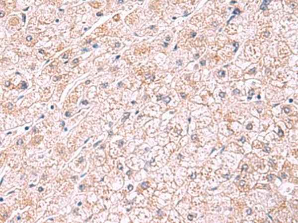 Anti-Human/Mouse/Rat PDRG1 Antibody