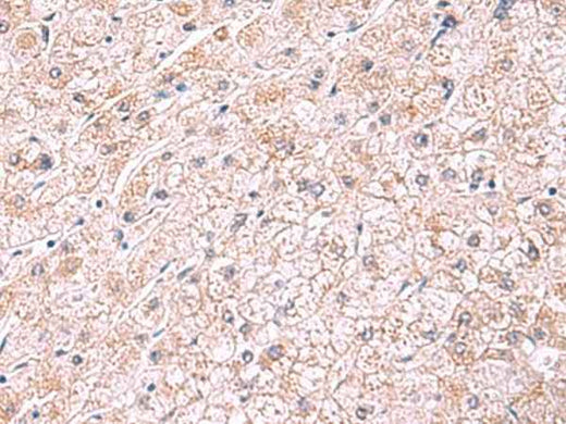Anti-Human/Mouse/Rat PDRG1 Antibody