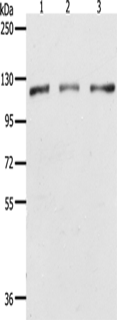 Anti-Human/Mouse/Rat PARP1 Antibody - ABMIUM