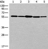 Western blot analysis of 293T cell HUVEC cell Hela cell lysates using RAD23B Polyclonal Antibody at dilution of 1:350