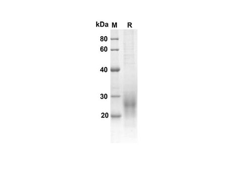 SDS-PAGE analysis of Mouse ACVRL1 proteins, 2 μg/lane of Recombinant Mouse ACVRL1 proteins was resolved with an SDS-PAGE under reducing conditions, showing bands at 10.5 kDa.