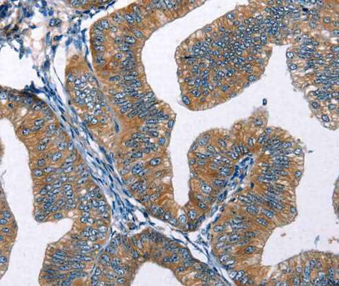 Anti-Human EDN2 Antibody