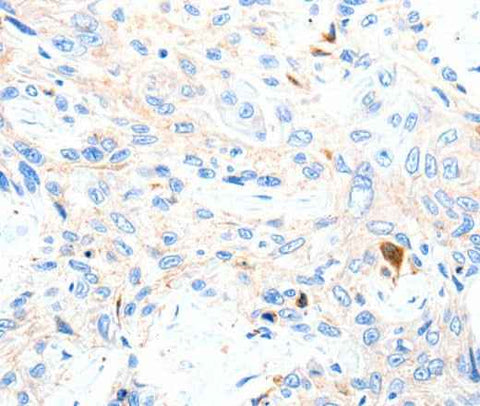 Anti-Human/Mouse/Rat P2RY1 Antibody
