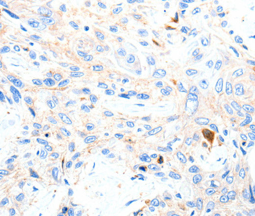 Anti-Human/Mouse/Rat P2RY1 Antibody - ABMIUM