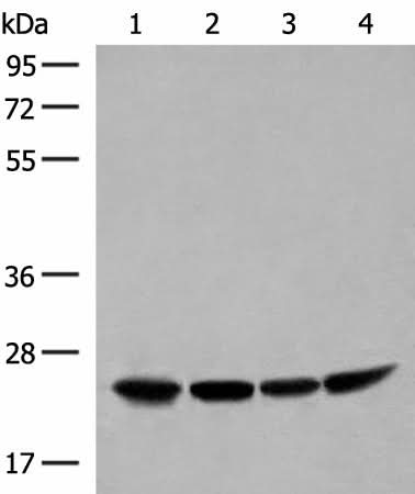 Western blot analysis of Human fetal liver tissue HepG2 K562 and Raji cell lysates using DTYMK Polyclonal Antibody at dilution of 1:400