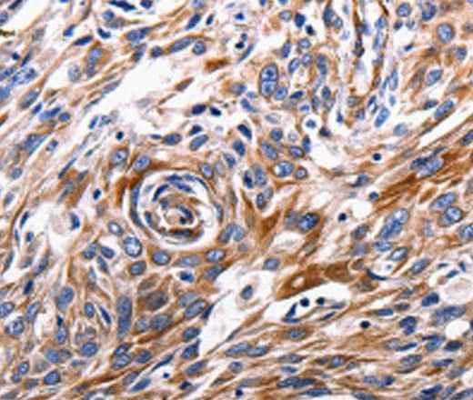 Anti-Human/Mouse/Rat ACE2 Antibody