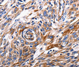 Anti-Human/Mouse/Rat ACE2 Antibody - ABMIUM