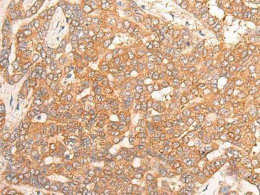 Anti-Human/Mouse/Rat CPS1 Antibody