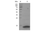 SDS-PAGE analysis of Human CXCL14 proteins, 2 μg/lane of Recombinant Human CXCL14 proteins was resolved with SDS-PAGE under reducing conditions, showing bands at 10 kDa.