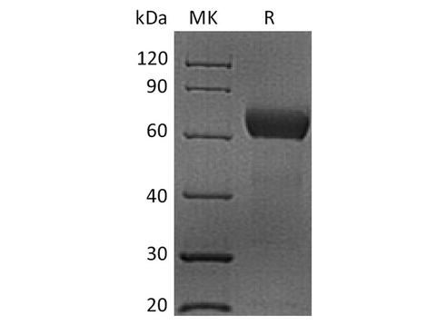 Recombinant Human CD48 Protein (mFc Tag) - ABMIUM