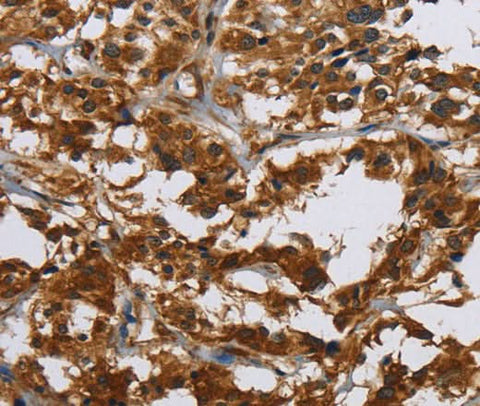 Anti-Human Claudin 2 Antibody - ABMIUM