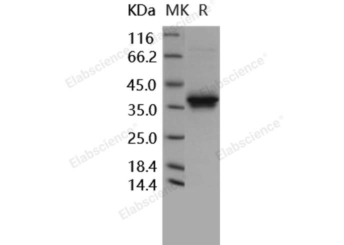 > 95 % as determined by reducing SDS-PAGE.