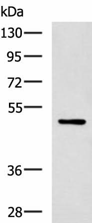 Western blot analysis of MCF-7 cell lysate using PAX2 Polyclonal Antibody at dilution of 1:400