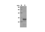 SDS-PAGE analysis of Mouse CXCL2/MIP-2 proteins, 2 μg/lane of Recombinant Mouse CXCL2/MIP-2 proteins was resolved with SDS-PAGE under reducing conditions, showing bands at 27 kDa.
