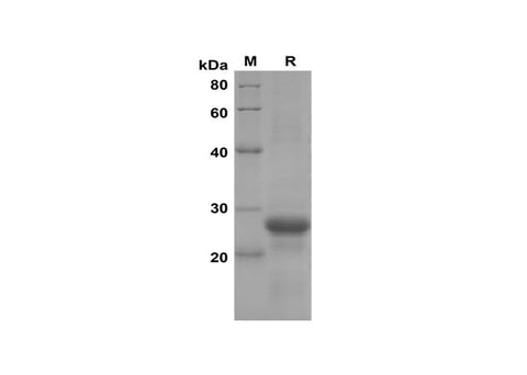 SDS-PAGE analysis of Mouse CXCL2/MIP-2 proteins, 2 μg/lane of Recombinant Mouse CXCL2/MIP-2 proteins was resolved with SDS-PAGE under reducing conditions, showing bands at 27 kDa.