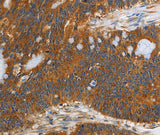 Anti-Human/Mouse/Rat PI 3 Kinase Class 3 Antibody - ABMIUM