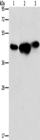Anti-Human/Mouse ARFGAP1 Antibody - ABMIUM