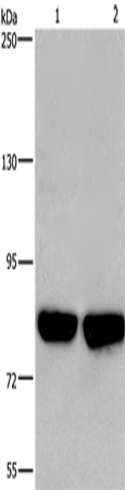 Anti-Human/Mouse/Rat PFKP Antibody - ABMIUM