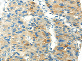 Anti-Human PDPN Antibody - ABMIUM